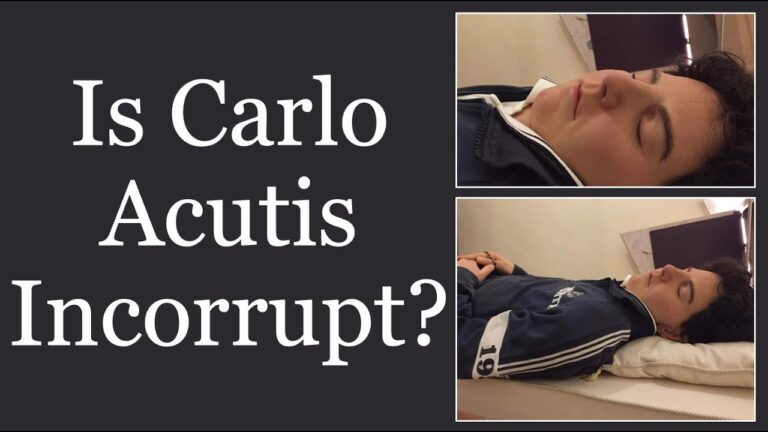 The Miraculous Preservation of Carlo Acutis’ Body