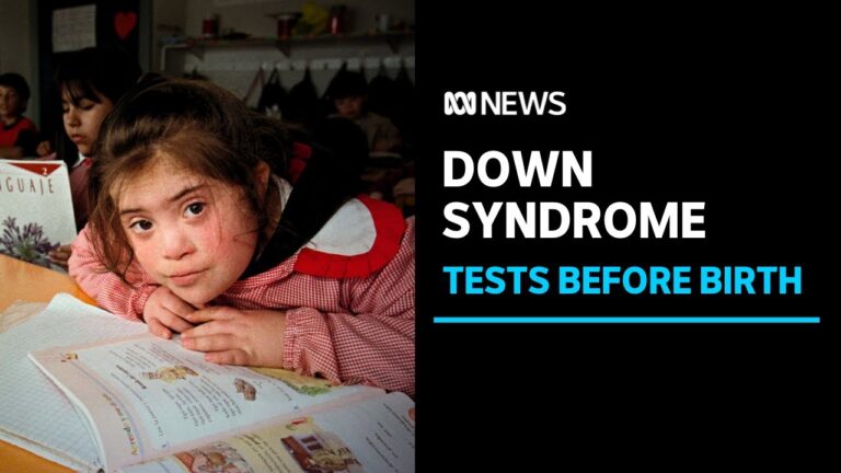 Understanding Down Syndrome in Iceland: Challenges and Progress